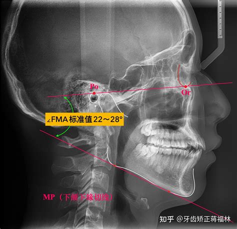 角意思|角